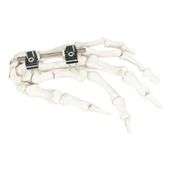 FX04