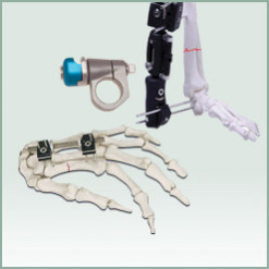 Orthopedic External Fixator
